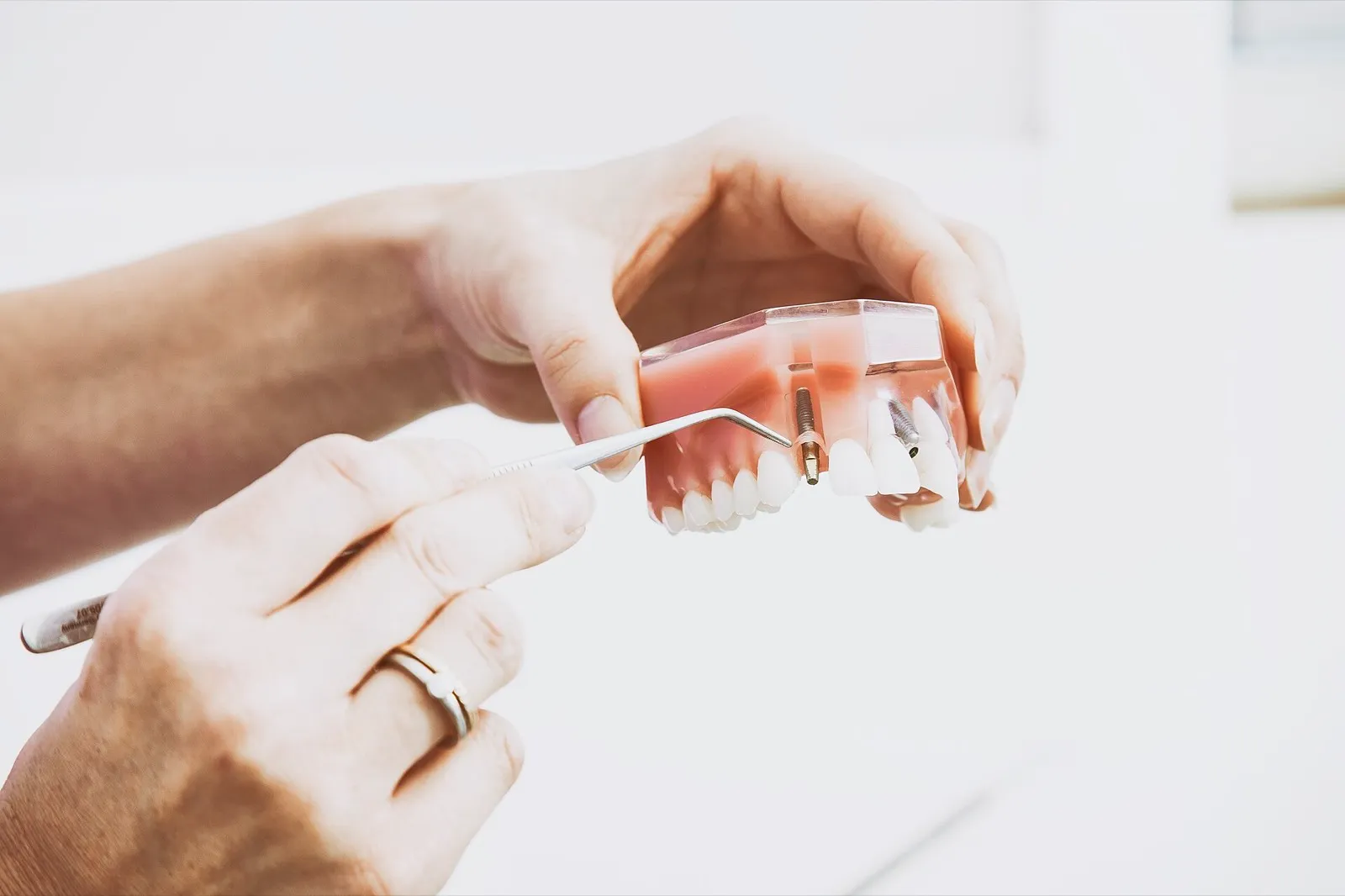 Mãos de luvas mostrando um modelo de arcada dentária sobre fundo branco